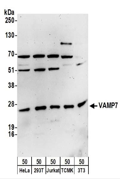 IHC-plus™ VAMP7 / SYBL1 / T1 VAMP Antibody (aa105-155)