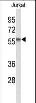 IHC-plus™ Polyclonal Rabbit anti-Human SACM1L / SAC1 Antibody (aa408-436, IHC, WB)