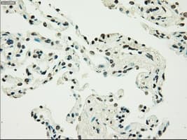 Monoclonal Mouse anti-Human PMEL / SILV / gp100 Antibody (clone OTI10E5, IHC, IF, WB)