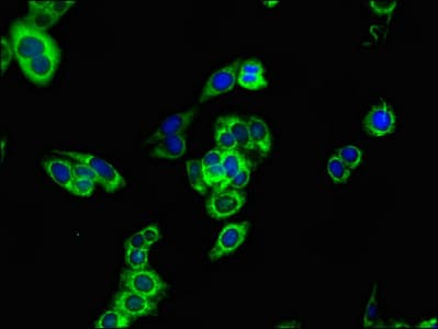 CPT1B Antibody