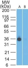 Monoclonal Mouse anti-Human EPCAM Antibody (clone 60N5D8, aa289-335, IHC, WB)