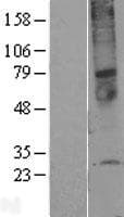 TMEM45A Protein (Over-Expression Lysate Myc-DDK (Flag))