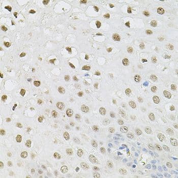 SET / TAF-I Antibody