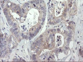 RIPK1 / RIP Antibody (aa133-422, clone OTI2D6, Carrier-free)