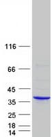 Human ERGIC1 Protein (Recombinant Myc-DDK (Flag))