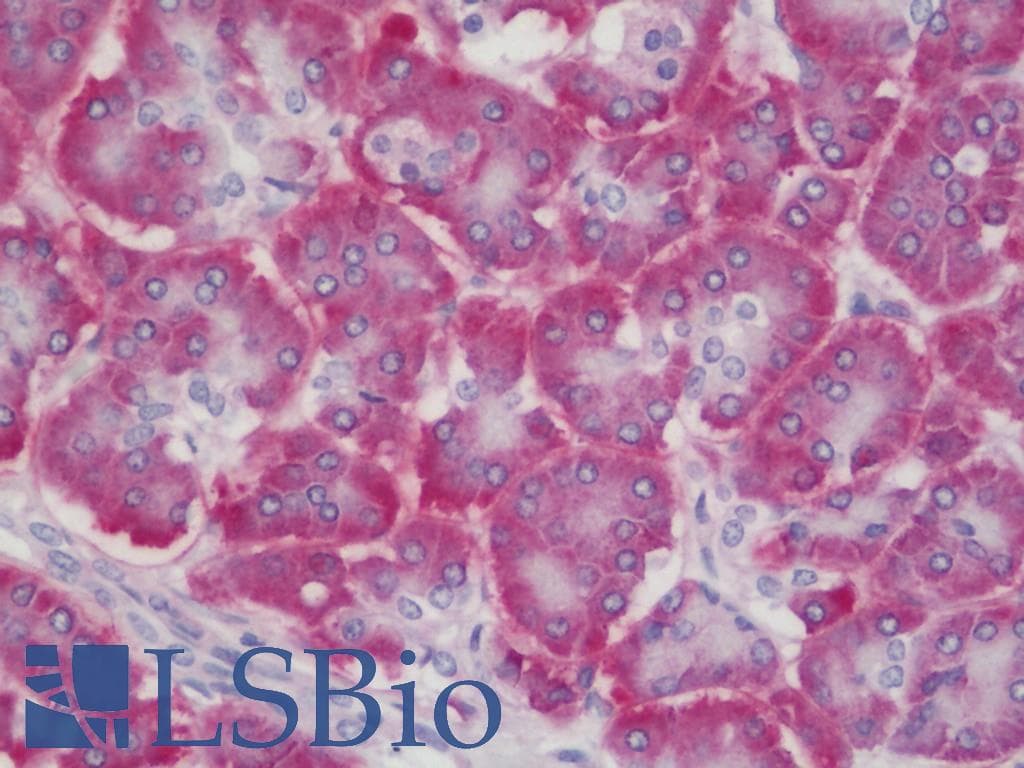 IHC-plus™ MYD88 Antibody (clone 1B4)