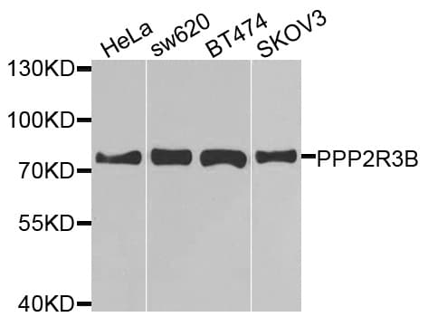PPP2R3B Antibody