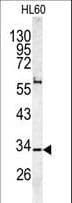 Polyclonal Rabbit anti-Human CAPZA1 / CAPZ Alpha 1 Antibody (aa1-30, IF, WB)
