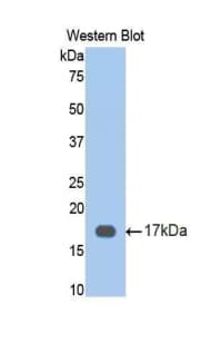 CETP Antibody (aa353-470)