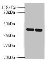 AVPR1B Antibody