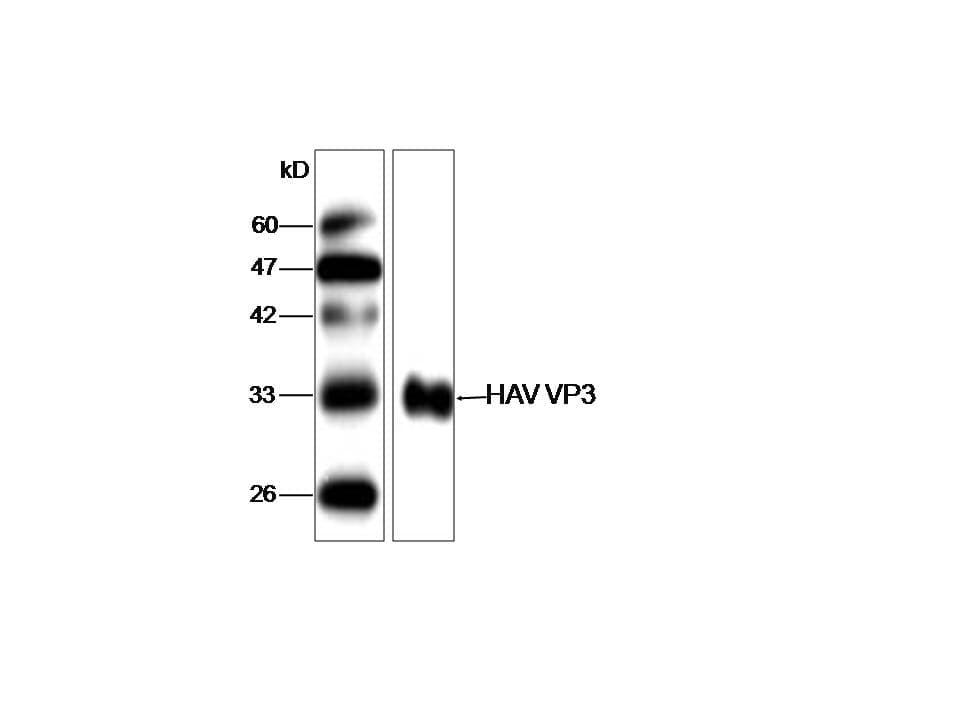 Monoclonal Mouse anti-Hepatitis A Virus HAV VP3 Antibody (WB)