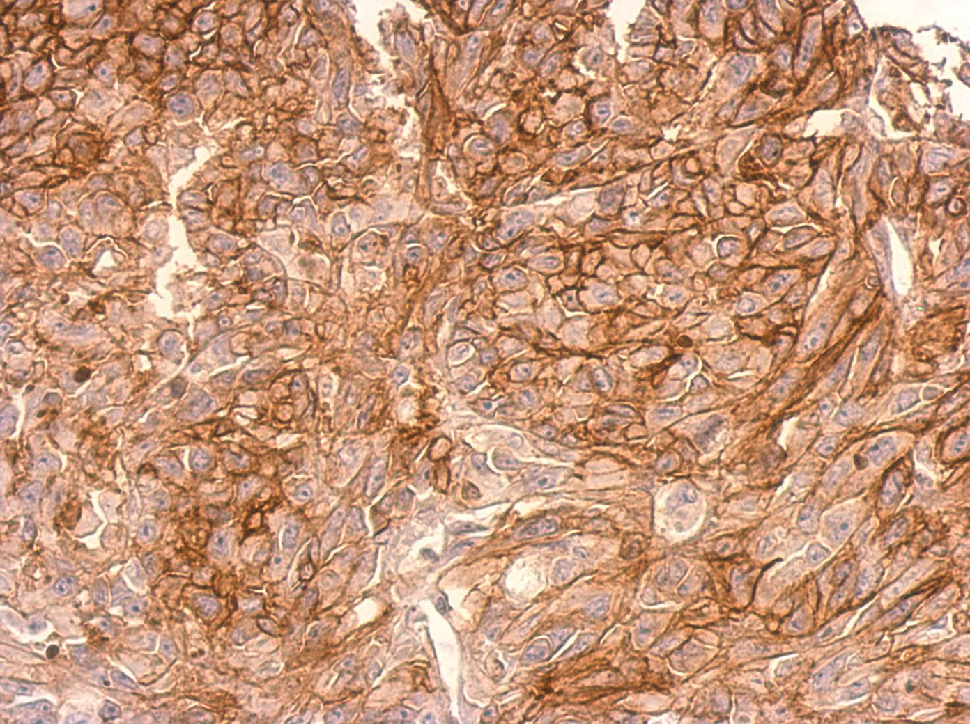 Polyclonal Rabbit anti-Human ADAMTSL2 Antibody (aa796-951, IHC, WB)