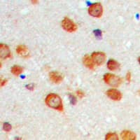CYP2C19 Antibody (Internal)