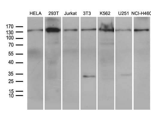 SMC1A / SMC1 Antibody (aa889-1016, clone OTI1C5)