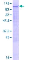 Human PFKM / PFK-1 Protein (Recombinant GST)