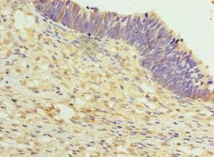 Polyclonal Rabbit anti-Human TET2 Antibody (aa1833-2002, IHC)