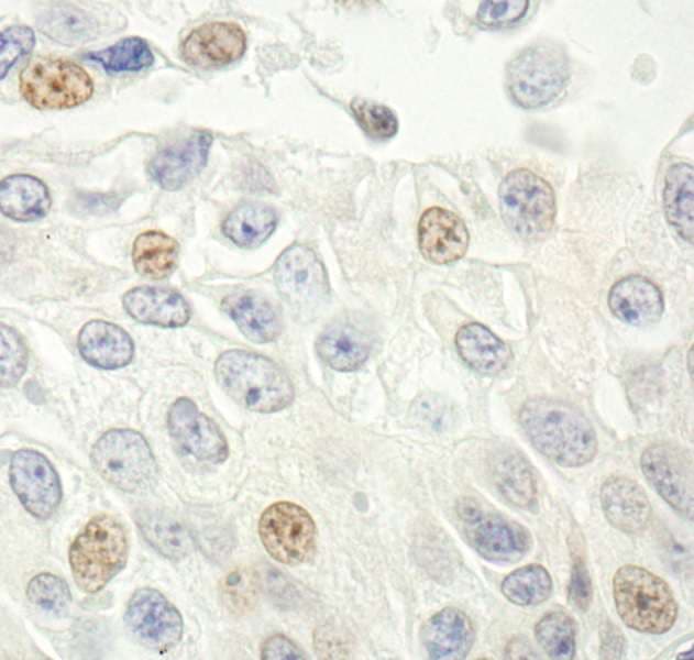 Polyclonal Rabbit anti-Human p14ARF / CDKN2A Antibody (aa125-C-term, IHC, WB)