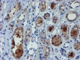 Monoclonal Mouse anti-Human Mannose Phosphate Isomerase Antibody (clone OTI4E7, IHC, WB)
