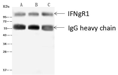 Polyclonal Rabbit anti-Human CD119 / IFNGR1 Antibody (Preservative Free, IHC, WB)