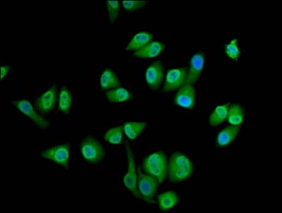 Polyclonal Rabbit anti-Human SEC14L2 Antibody (IHC, IF, WB)