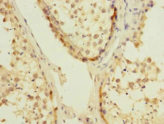 Polyclonal Rabbit anti-Human UBE2S / E2 EPF Antibody (IHC)