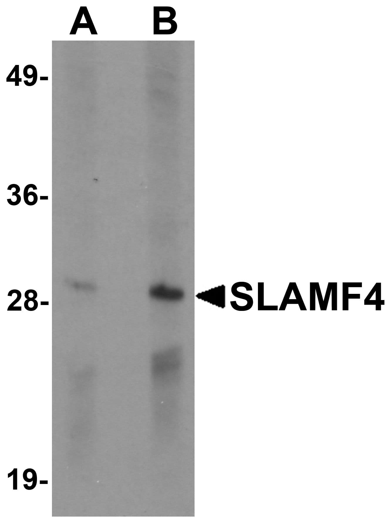 Polyclonal Rabbit anti-Human CD244 Antibody (IF, WB)