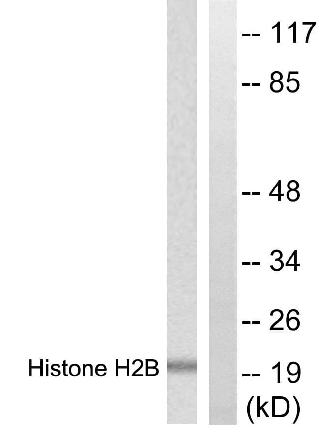 IHC-plus™ Polyclonal Rabbit anti-Human Histone H2B Antibody (aa11-60, IHC, WB)