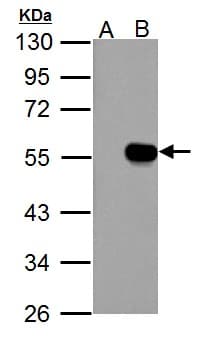 Polyclonal Rabbit anti-Human IP6K1 Antibody (aa50-309, IHC, WB)