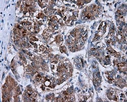 PIM2 / Pim-2 Antibody (clone OTI5B5)