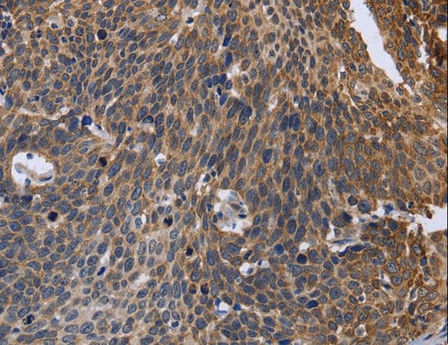 GABPB2 Antibody