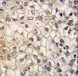 Polyclonal Rabbit anti-Human CYP2F / CYP2F1 Antibody (aa395-424, IHC, WB)
