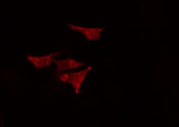 EPS8L2 Antibody (aa19-48)