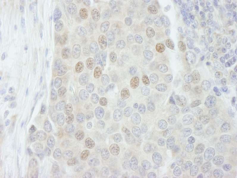 RBM27 Antibody (aa700-750)