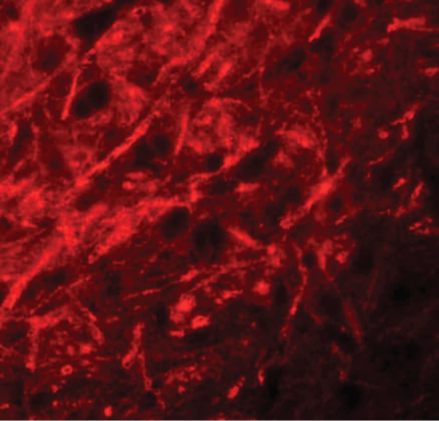 IHC-plus™ CTNNBL1 / NAP Antibody