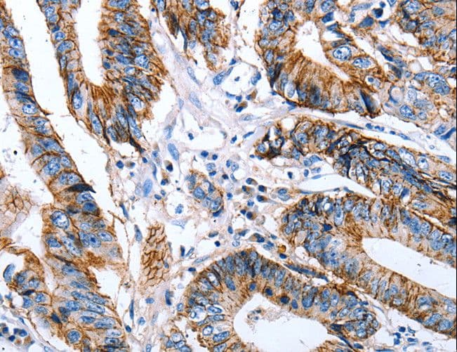CLDN7 / Claudin 7 Antibody