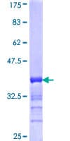 Human RSHL1 Protein (Recombinant GST)