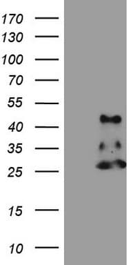 NDUFB11 Antibody (aa30-163, clone OTI8C5)