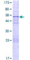 Human ANGEL2 Protein (Recombinant GST)