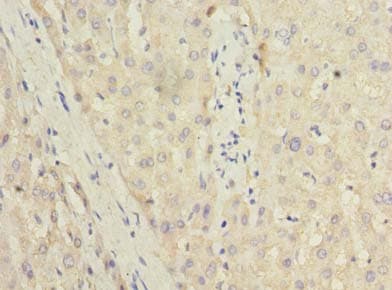 TRIT1 Antibody