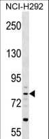 ASPIC1 / CRTAC1 Antibody (aa130-156)