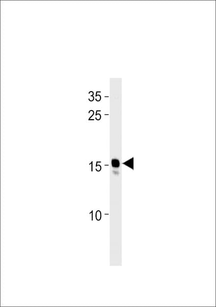 Polyclonal Rabbit anti-Zebrafish NDUFAF3 Antibody (aa19-45, WB)