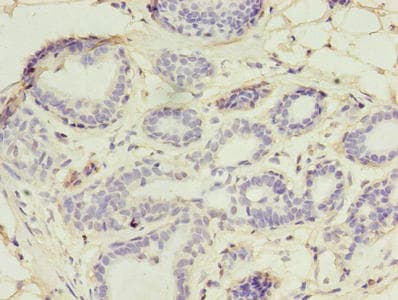 UBE2D1 / UBCH5 Antibody