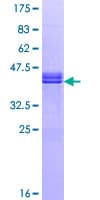 Human RGCC Protein (Recombinant GST)