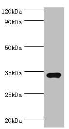 Polyclonal Rabbit anti-Human M-PST / STM Antibody (aa1-295, IHC, WB)