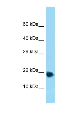 RPL32 / Ribosomal Protein L32 Antibody (aa61-110)