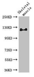 Polyclonal Rabbit anti-Human RBL1 / p107 Antibody