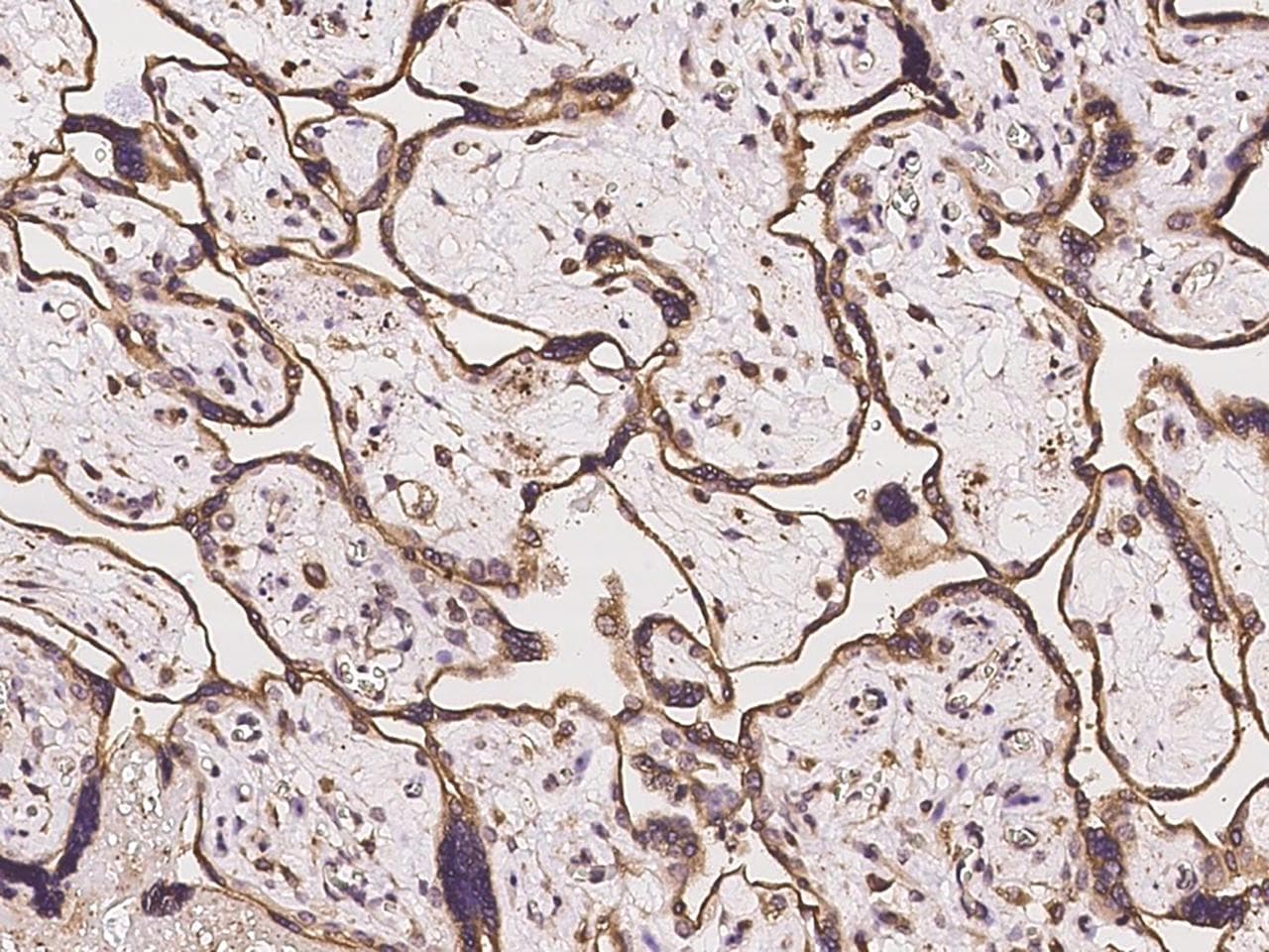 TMPRSS4 Antibody