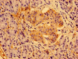 PSORS1C1 Antibody