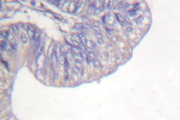 Polyclonal Rabbit anti-Human PLCG1 Antibody (Gly777, IHC, WB)