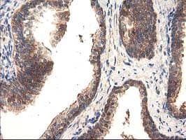 TFG Antibody (clone OTI2C3)
